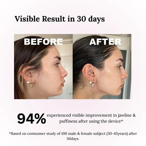 Valento Facial Sculpt Pro