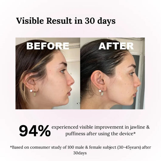 Valento Facial Sculpt Pro